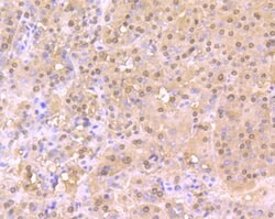 Invitrogen Cullin 4A Recombinant Rabbit Monoclonal Antibody (JU07-33) 100 &mu;L | Buy Online | Invitrogen&trade; | Fisher Scientific