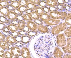 Invitrogen Cullin 4A Recombinant Rabbit Monoclonal Antibody (JU07-33) 100 &mu;L | Buy Online | Invitrogen&trade; | Fisher Scientific