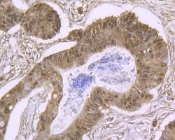 Invitrogen Cullin 4A Recombinant Rabbit Monoclonal Antibody (JU07-33) 100 &mu;L | Buy Online | Invitrogen&trade; | Fisher Scientific