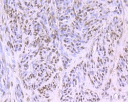 Invitrogen Cullin 4A Recombinant Rabbit Monoclonal Antibody (JU07-33) 100 &mu;L | Buy Online | Invitrogen&trade; | Fisher Scientific