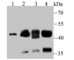 Invitrogen NCK1 Recombinant Rabbit Monoclonal Antibody (JU41-80) 100 &mu;L | Buy Online | Invitrogen&trade; | Fisher Scientific