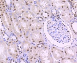Invitrogen PTBP1 Recombinant Rabbit Monoclonal Antibody (JU41-20) 100 &mu;L;