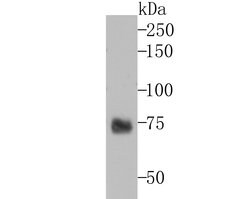 Invitrogen TYRP1 Recombinant Rabbit Monoclonal Antibody (JU36-48) 100 &mu;L | Buy Online | Invitrogen&trade; | Fisher Scientific