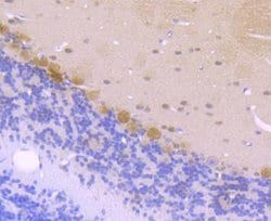 Invitrogen CK2 beta Recombinant Rabbit Monoclonal Antibody (JU37-62) 100