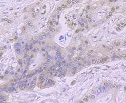 Invitrogen CK2 beta Recombinant Rabbit Monoclonal Antibody (JU37-62) 100