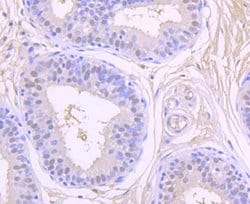 Invitrogen CK2 beta Recombinant Rabbit Monoclonal Antibody (JU37-62) 100