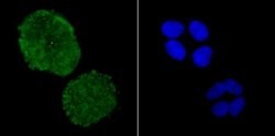 Invitrogen ADAR1 Recombinant Rabbit Monoclonal Antibody (JU99-33) 100 &mu;L;