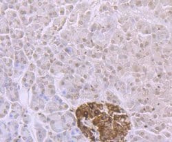Invitrogen ADAR1 Recombinant Rabbit Monoclonal Antibody (JU99-33) 100 &mu;L;