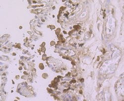 Invitrogen ADAR1 Recombinant Rabbit Monoclonal Antibody (JU99-33) 100 &mu;L;