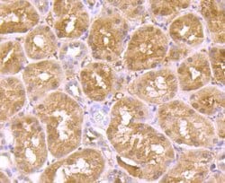 Invitrogen ADAR1 Recombinant Rabbit Monoclonal Antibody (JU99-33) 100 &mu;L;