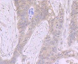 Invitrogen ADAR1 Recombinant Rabbit Monoclonal Antibody (JU99-33) 100 &mu;L;