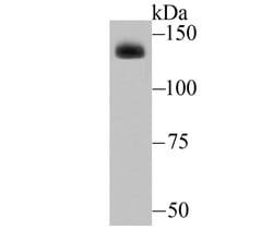Invitrogen ADAR1 Recombinant Rabbit Monoclonal Antibody (JU99-33) 100 &mu;L;