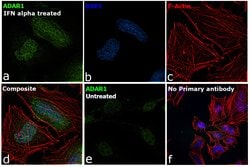 Invitrogen ADAR1 Recombinant Rabbit Monoclonal Antibody (JU99-33) 100 &mu;L;