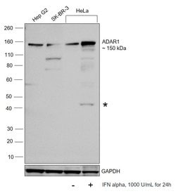 Invitrogen ADAR1 Recombinant Rabbit Monoclonal Antibody (JU99-33) 100 &mu;L;