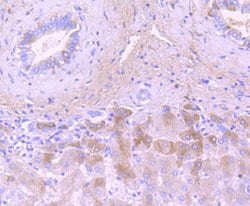 Thermo Scientific Complement C3 Recombinant Rabbit Monoclonal Antibody
