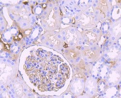 Thermo Scientific Complement C3 Recombinant Rabbit Monoclonal Antibody