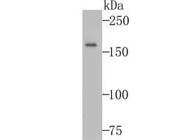 Thermo Scientific Complement C3 Recombinant Rabbit Monoclonal Antibody