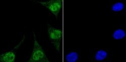 Invitrogen ENDOG Recombinant Rabbit Monoclonal Antibody (JU31-30) 100 &mu;L;