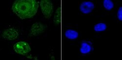 Invitrogen ENDOG Recombinant Rabbit Monoclonal Antibody (JU31-30) 100 &mu;L;