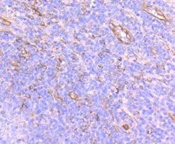 Invitrogen SEC23A Recombinant Rabbit Monoclonal Antibody (JU37-48) 100