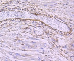 Invitrogen SEC23A Recombinant Rabbit Monoclonal Antibody (JU37-48) 100