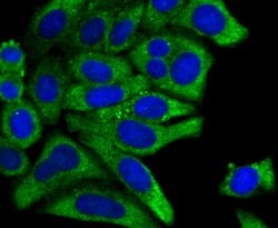 Thermo Scientific PCK1 Recombinant Rabbit Monoclonal Antibody (JU84-39):Antibodies,