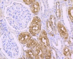 Thermo Scientific PCK1 Recombinant Rabbit Monoclonal Antibody (JU84-39):Antibodies,