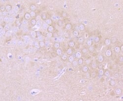Invitrogen MMP17 Recombinant Rabbit Monoclonal Antibody (JU33-03) 100 &mu;L;