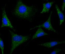 Invitrogen CRMP1 Recombinant Rabbit Monoclonal Antibody (JU73-30) 100 &mu;L;