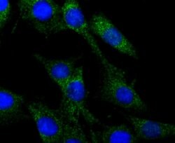Invitrogen CRMP1 Recombinant Rabbit Monoclonal Antibody (JU73-30) 100 &mu;L;