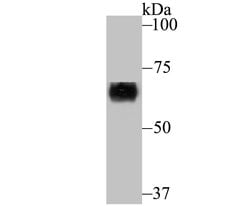 Invitrogen CRMP1 Recombinant Rabbit Monoclonal Antibody (JU73-30) 100 &mu;L;