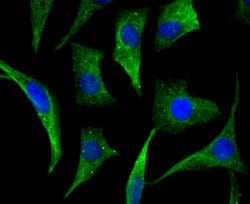 Invitrogen CAS Recombinant Rabbit Monoclonal Antibody (JU34-33) 100 &mu;L;