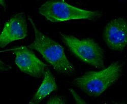 Invitrogen CAS Recombinant Rabbit Monoclonal Antibody (JU34-33) 100 &mu;L;