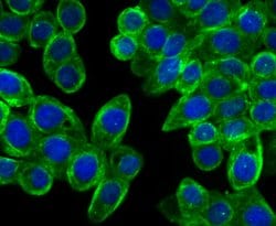 Invitrogen CAS Recombinant Rabbit Monoclonal Antibody (JU34-33) 100 &mu;L;