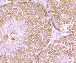 Invitrogen CAS Recombinant Rabbit Monoclonal Antibody (JU34-33) 100 &mu;L;