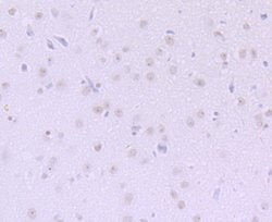 Invitrogen DKC1 Recombinant Rabbit Monoclonal Antibody (JU34-32) 100 &mu;L;