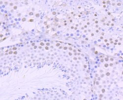 Invitrogen DKC1 Recombinant Rabbit Monoclonal Antibody (JU34-32) 100 &mu;L;