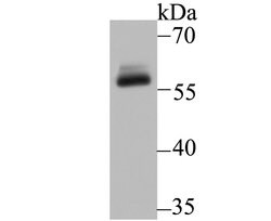Invitrogen DKC1 Recombinant Rabbit Monoclonal Antibody (JU34-32) 100 &mu;L;
