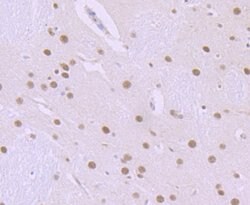 Invitrogen ILF2 Recombinant Rabbit Monoclonal Antibody (JU50-33) 100 &mu;L;