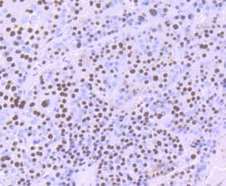 Invitrogen ILF2 Recombinant Rabbit Monoclonal Antibody (JU50-33) 100 &mu;L;
