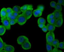 Invitrogen PFKM Recombinant Rabbit Monoclonal Antibody (JU53-31) 100 &mu;L | Buy Online | Invitrogen&trade; | Fisher Scientific