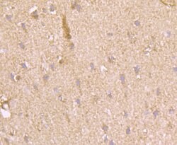 Invitrogen PFKM Recombinant Rabbit Monoclonal Antibody (JU53-31) 100 &mu;L | Buy Online | Invitrogen&trade; | Fisher Scientific