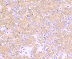 Invitrogen PFKM Recombinant Rabbit Monoclonal Antibody (JU53-31) 100 &mu;L | Buy Online | Invitrogen&trade; | Fisher Scientific