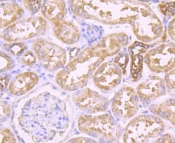 Invitrogen PFKM Recombinant Rabbit Monoclonal Antibody (JU53-31) 100 &mu;L | Buy Online | Invitrogen&trade; | Fisher Scientific