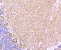 Invitrogen MAPRE3 Recombinant Rabbit Monoclonal Antibody (JU38-30) 100