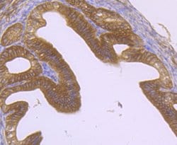 Invitrogen MAPRE3 Recombinant Rabbit Monoclonal Antibody (JU38-30) 100