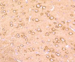 Invitrogen MAPRE3 Recombinant Rabbit Monoclonal Antibody (JU38-30) 100