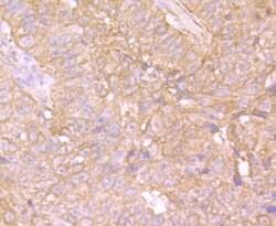 Invitrogen MAPRE3 Recombinant Rabbit Monoclonal Antibody (JU38-30) 100