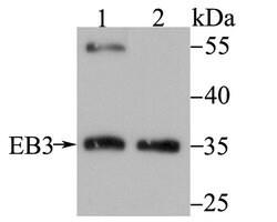 Invitrogen MAPRE3 Recombinant Rabbit Monoclonal Antibody (JU38-30) 100