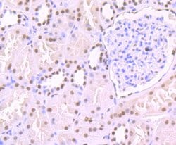 Invitrogen SF3B1 Recombinant Rabbit Monoclonal Antibody (JB40-32) 100 &mu;L;